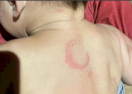 Preso por espancar bebê já havia sido detido por agredir companheira grávida