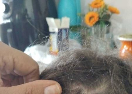 Criança é socorrida ao ser atingida de raspão por bala perdida na cabeça