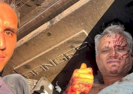 “Nunca vi nada igual”, diz policial que encarou chamas para salvar motorista