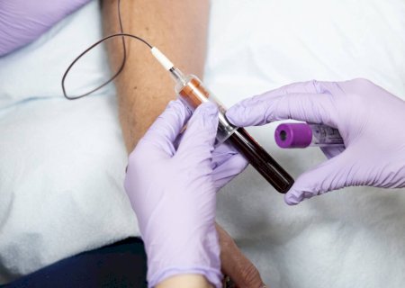 Nova pílula para colesterol é aprovada nos EUA; veja o que muda e quando pode chegar ao Brasil