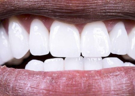 Como proteger as boas bactérias da sua boca