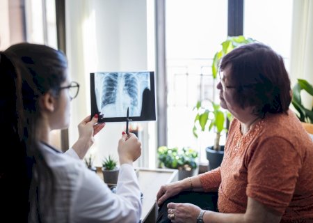 Por que o câncer de pulmão virou uma grande preocupação para mulheres | Letra de Médico