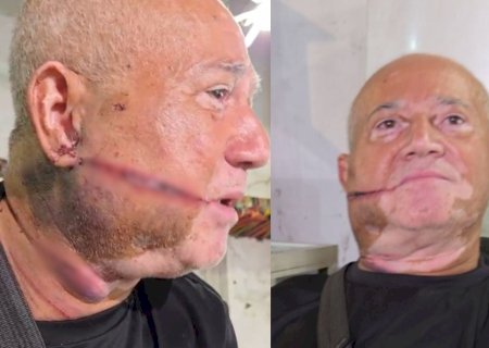 Idoso acorda com facão no rosto, luta com bandido e tenta se salvar