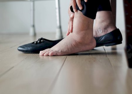 Cicatrização de feridas no diabetes é desafio para o paciente e a ciência