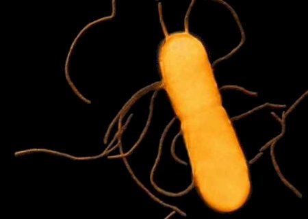 Venda de linguiça é suspensa por contaminação com bactéria ligada à doença grave