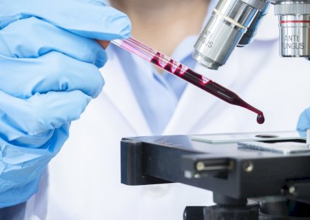 Teste de sangue que detecta sinal associado a mais de 50 tipos de câncer chega ao Brasil