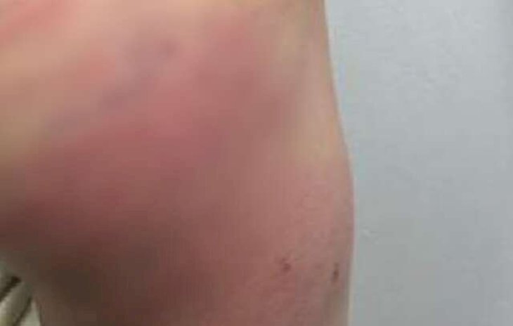 PolicialPadrasto é preso em flagrante por espancar menino de 5 anos com galho de amora